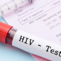  Bari: domani test gratuiti dell’HIV sulle spiagge di Pane e Pomodoro e Torre Quetta