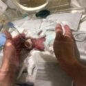  Giappone: era nato che pesava 268 grammi, lascia l’ospedale in buona salute