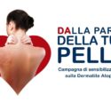  A Catanzaro e Reggio Calabria visite dermatologiche gratuite per la dermatite atopica