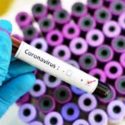  Coronavirus: sale il numero di contagi, il più alto aumento dalla seconda metà di aprile